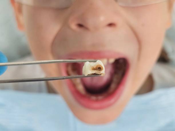 Best Walk-In Emergency Dentist in Carolina Shores, NC